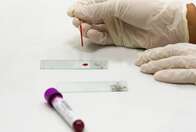 Sublinhagem da ômicron BA.2 é capaz de contaminar mesmo quem tomou três doses da vacina