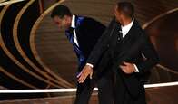Será que o tapa de Will Smith em Chris Rock foi combinado para promover um remédio para alopecia?