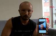 Dia quente na praia faz turco ficar com cabeça inchada por condição raríssima