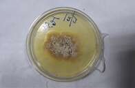 Indiano se torna a primeira pessoa da história a ser infectada por um fungo até então exclusivo de plantas